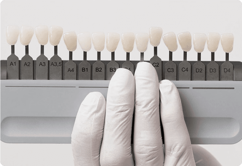 Dental Implants in Spain