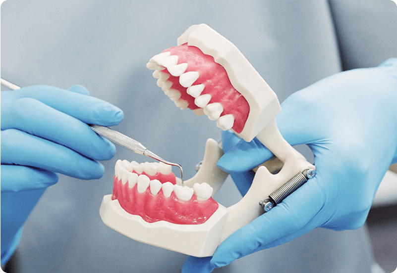Tooth Extraction in Spain